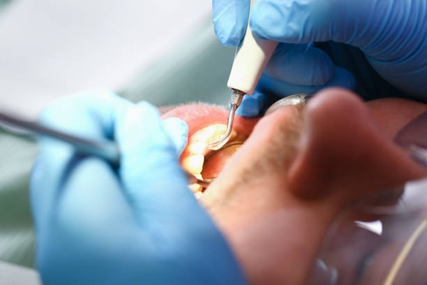 Best Emergency Treatment for Oral Infections in Pinehurst, ID