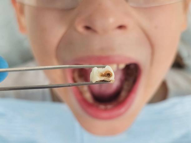 Best 24-Hour Emergency Dental Care in Pinehurst, ID